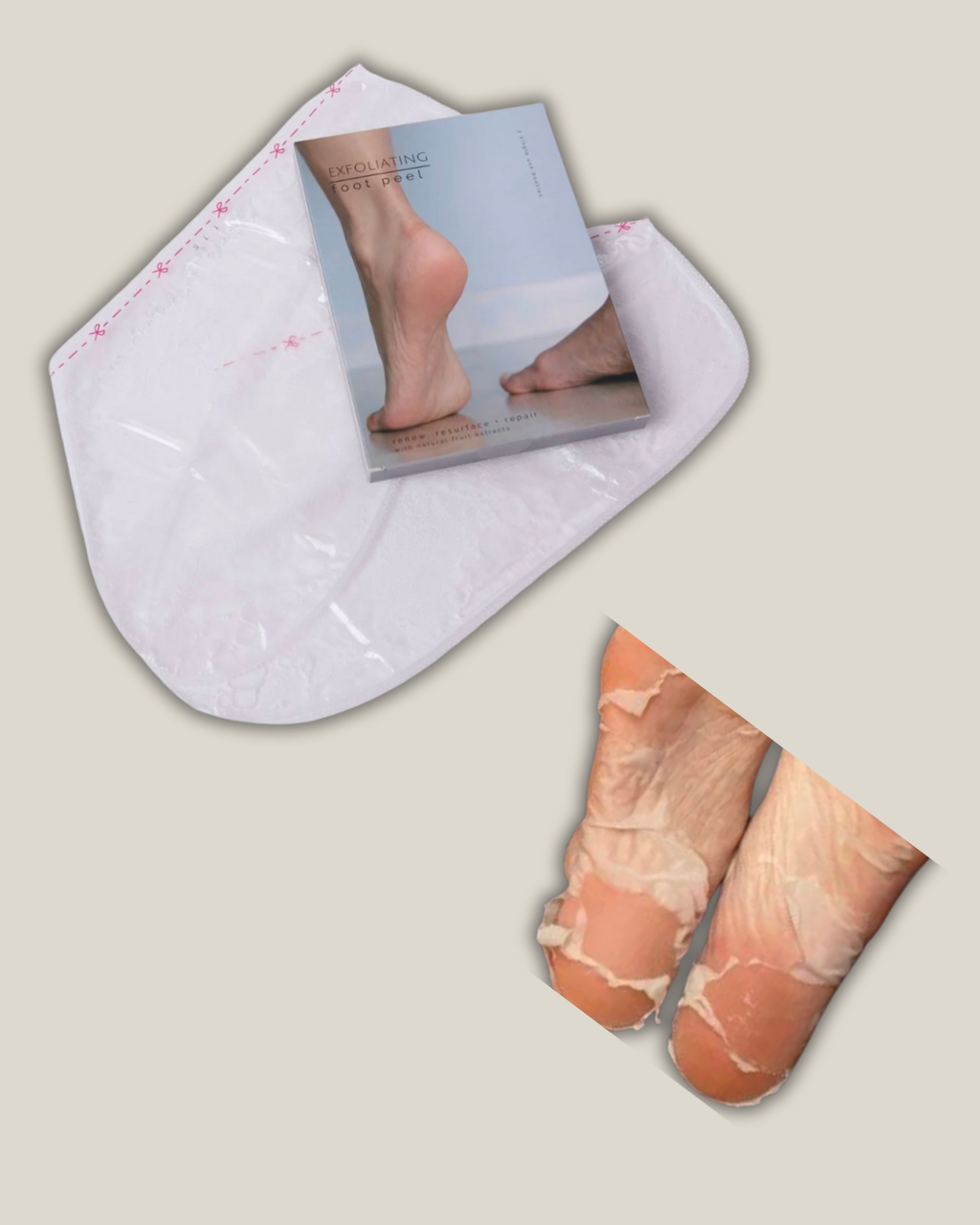 Foot Peel